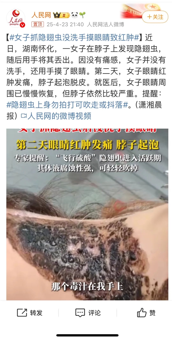 有人因此“毁容”！近期这种虫子很活跃 遇到千万不能拍