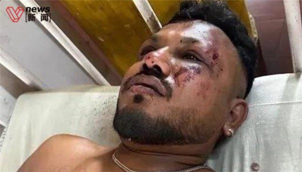 印度空难“11A”是神奇逃生位置吗 专家：不存在 生还纯属幸运