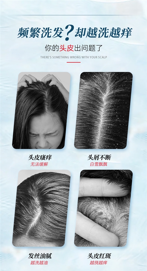 999官方旗舰店：1%二硫化硒洗发水19元（大差价）