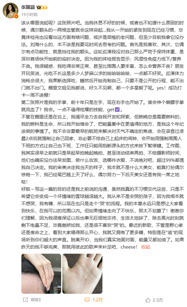张靓颖自曝体检查出营养不良：额头血管莫名突起 伸懒腰手掌就流血